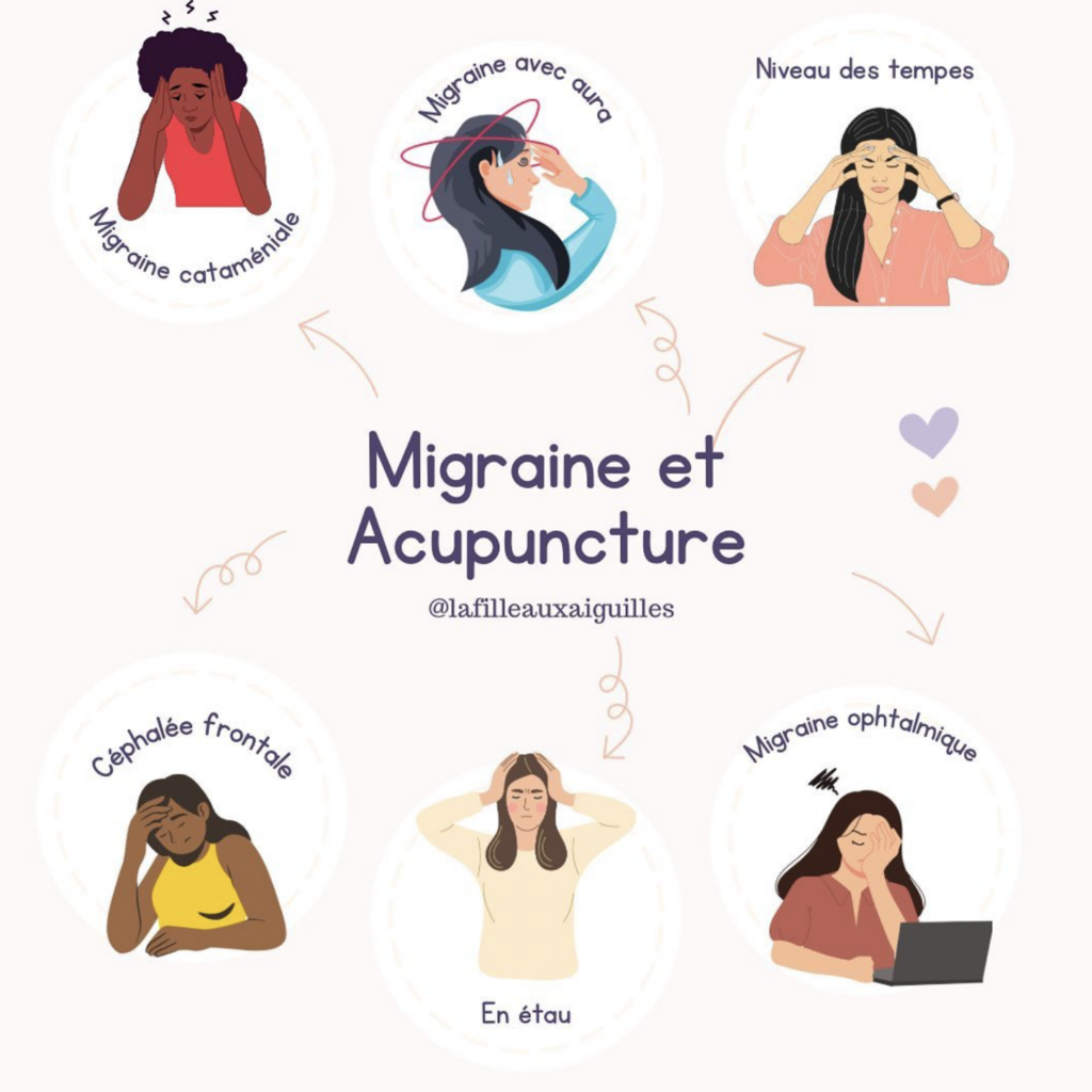 migraine et acupuncture