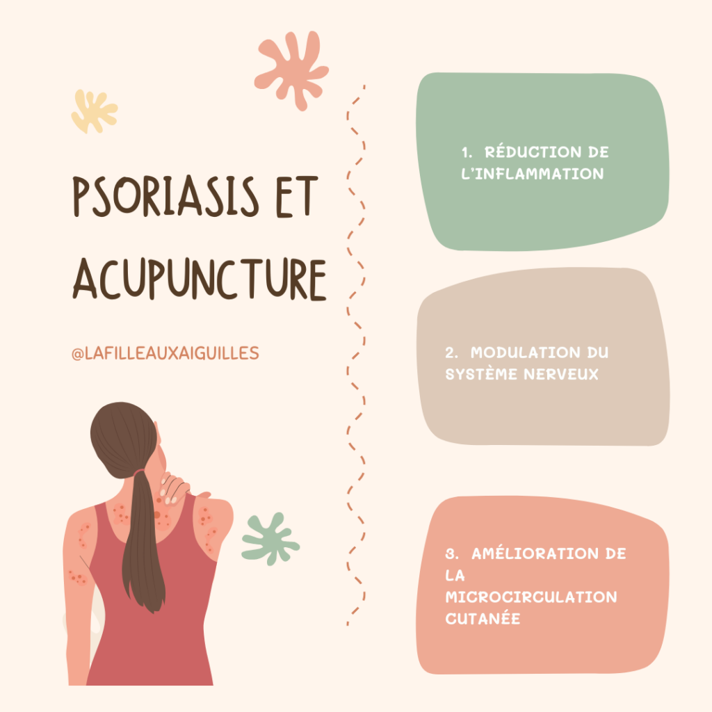 Graphique montrant les effets de l'acupuncture sur le psoriasis : réduction de 55 % de l'indice PASI dans une étude clinique, amélioration des démangeaisons et de la qualité de vie selon des études récentes